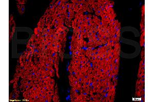 Formalin-fixed and paraffin embedded rat heart tissue labeled with Rabbit Anti-DOG-1/TMEM16A Polyclonal Antibody, Unconjugated (ABIN704216) at 1:200 followed by conjugation to the secondary antibody and DAB staining. (ANO1 抗体  (AA 151-250))