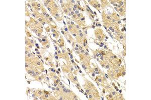 Immunohistochemistry of paraffin-embedded human stomach using TNNI3 antibody at dilution of 1:100 (x400 lens). (TNNI3 抗体)