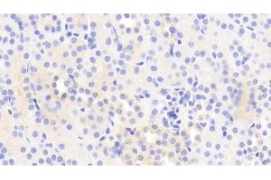 Detection of MYO1E in Mouse Kidney Tissue using Polyclonal Antibody to Myosin IE (MYO1E) (MYO1E 抗体  (AA 772-1033))