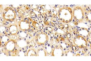 Immunohistochemistry (IHC) image for anti-Orosomucoid 2 (ORM2) antibody (ABIN7442267)