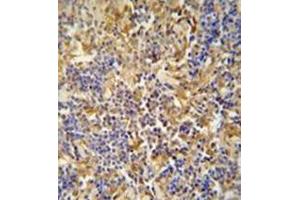 Immunohistochemistry analysis in formalin fixed and paraffin embedded human lymph tissue reacted with IBTK / BTKI Antibody (Center) followed which was peroxidase conjugated to the secondary antibody and followed by DAB staining.