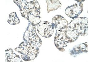 EPS8L1 antibody was used for immunohistochemistry at a concentration of 4-8 ug/ml to stain Decidual cells (arrows) in Human Placenta. (EPS8-Like 1 抗体  (N-Term))