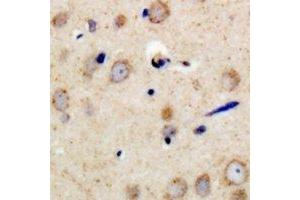 Immunohistochemical analysis of PSMD11 staining in human brain formalin fixed paraffin embedded tissue section. (PSMD11 抗体)