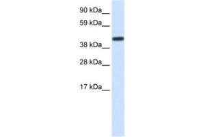 Western Blotting (WB) image for anti-CCR4-NOT Transcription Complex, Subunit 2 (CNOT2) antibody (ABIN2460364) (CNOT2 抗体)