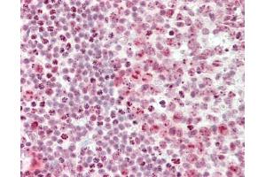 Immunohistochemistry (Paraffin-embedded Sections) (IHC (p)) image for anti-Cleavage Stimulation Factor, 3' Pre-RNA, Subunit 3, 77kDa (CSTF3) (AA 71-120) antibody (ABIN6756546)