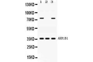Western blot analysis of AKR1B1 expression in rat cardiac muscle extract ( Lane 1), human placenta extract ( Lane 2) and HELA whole cell lysates ( Lane 3). (AKR1B1 抗体  (AA 228-316))