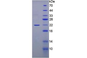 SDS-PAGE analysis of active recombinant Rat GREM1. (GREM1 蛋白)