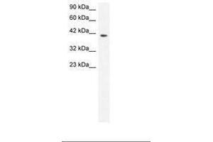 Image no. 3 for anti-Matrix Metallopeptidase 19 (MMP19) (AA 56-105) antibody (ABIN6735807) (MMP19 抗体  (AA 56-105))