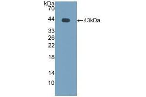 Detection of Recombinant MCP2, Bovine using Polyclonal Antibody to Monocyte Chemotactic Protein 2 (MCP2) (CCL8 抗体  (AA 1-99))
