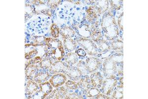 Immunohistochemistry (IHC) image for anti-Potassium Inwardly-Rectifying Channel, Subfamily J, Member 15 (KCNJ15) (AA 221-375) antibody (ABIN7269475)