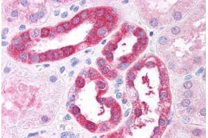 Human Renal Tubular Epithelium (formalin-fixed, paraffin-embedded) stained with RICTOR antibody ABIN297558 at 2. (RICTOR 抗体  (AA 1722-1732))