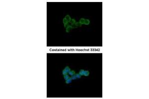 ICC/IF Image Immunofluorescence analysis of methanol-fixed A431, using DLST, antibody at 1:500 dilution. (DLST 抗体  (Center))