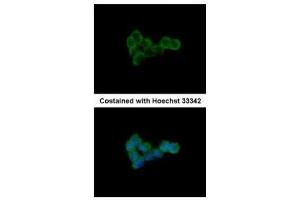 ICC/IF Image Immunofluorescence analysis of methanol-fixed A431, using DLST, antibody at 1:500 dilution.