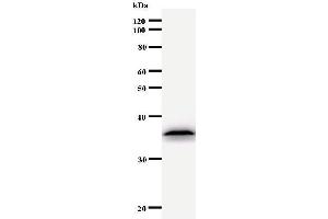 Western Blotting (WB) image for anti-Ubinuclein 1 (UBN1) antibody (ABIN930942) (Ubinuclein 1 抗体)