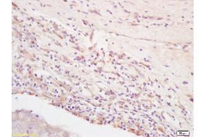 Formalin-fixed and paraffin embedded rat brain labeled with Rabbit Anti Integrin Alpha V + Beta 3 (CD51+CD61) Polyclonal Antibody, Unconjugated (ABIN674784) at 1:200 followed by conjugation to the secondary antibody and DAB staining (CD51/CD61 抗体)
