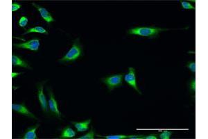 Immunofluorescence of purified MaxPab antibody to PDIA3 on HeLa cell. (PDIA3 抗体  (AA 1-505))