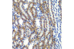 Immunohistochemistry of paraffin-embedded rat kidney using ZFAND3 antibody (ABIN5975562) at dilution of 1/100 (40x lens). (ZFAND3 抗体)