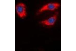 Immunofluorescent analysis of Synapsin 1 staining in MCF7 cells. (SYN1 抗体  (N-Term))