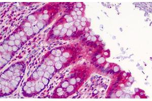 Human Colon: Formalin-Fixed, Paraffin-Embedded (FFPE) (SLFN12 抗体  (C-Term))