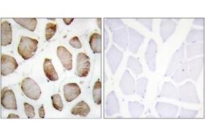 Immunohistochemistry analysis of paraffin-embedded human skeletal muscle tissue, using DUS2L Antibody. (DUSL2 抗体  (AA 421-470))