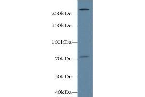 Detection of PLCe1 in Mouse Cerebrum lysate using Polyclonal Antibody to Phospholipase C Epsilon 1 (PLCe1) (PLCE1 抗体  (AA 1-250))