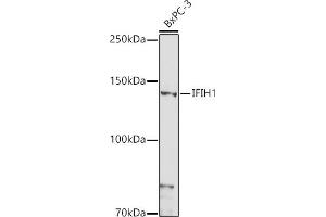 Western blot analysis of extracts of BxPC-3 cells, using IFIH1 antibody (ABIN6131879, ABIN6142174, ABIN6142175 and ABIN6217724) at 1:1000 dilution. (IFIH1 抗体  (AA 1-205))