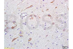 Formalin-fixed and rat brain tissue labeled with Anti-GABA Polyclonal Antibody, Unconjugated (ABIN679013) at 1:200 followed by conjugation to the secondary antibody and DAB staining (GABA 抗体)