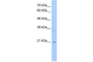 LOC728864 antibody used at 1 ug/ml to detect target protein. (LOC728864 (N-Term) 抗体)