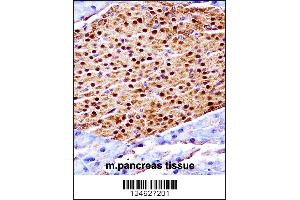 Mouse Scyl3 Antibody immunohistochemistry analysis in formalin fixed and paraffin embedded mouse pancreas tissue followed by peroxidase conjugation of the secondary antibody and DAB staining. (SCYL3 抗体  (C-Term))