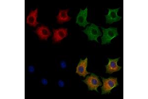 ABIN7094258 and ABIN7098305 staining HepG2 cells by IF/ICC. (GLRX3 抗体  (Internal Region))