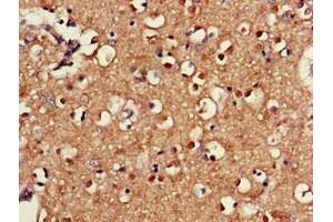 Immunohistochemistry of paraffin-embedded human brain tissue using ABIN7170561 at dilution of 1:100 (SAMD8 抗体  (AA 1-152))