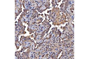 IHC analysis of Scavenging Receptor SRB2/SCARB2 using anti-Scavenging Receptor SRB2/SCARB2 antibody (ABIN7601833).