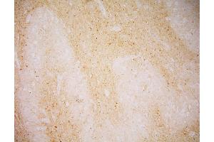 Immunohistochemistry of GCPII in human Medulla oblongata by monoclonal antibody. (PSMA 抗体  (AA 44-750))