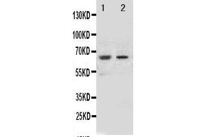 Anti-NOX1 antibody, Western blottingAll lanes: Anti NOX1  at 0. (NOX1 抗体  (Middle Region))