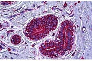 Immunohistochemistry (Formalin-fixed Paraffin-embedded Sections) (IHC (fp)) image for anti-ATP Synthase, H+ Transporting, Mitochondrial F1 Complex, alpha Subunit 1, Cardiac Muscle (ATP5A1) (AA 201-250) antibody (ABIN2878786)