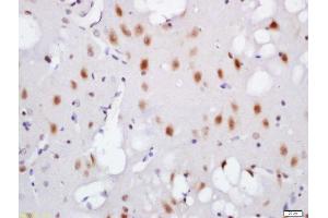 Formalin-fixed and paraffin embedded mouse brain labeled with Rabbit Anti-TNIK (Ser764) Polyclonal Antibody, Unconjugated (ABIN711941) at 1:200 followed by conjugation to the secondary antibody and DAB staining (TNIK 抗体  (pSer764))