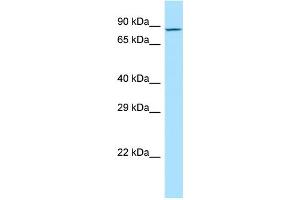 WB Suggested Anti-MDGA2 Antibody Titration: 1.