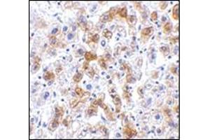 Immunohistochemistry of SCO2 in human liver tissue with this product at 2.