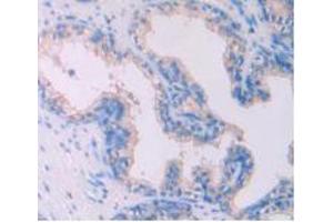 IHC-P analysis of Human Prostate Gland Tissue, with DAB staining. (IL-4 抗体  (AA 25-153))