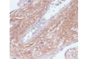 Immunohistochemistry of paraffin-embedded Human placenta using COL1A1 Polyclonal Antibody at dilution of 1:200 (40x lens). (COL1A1 抗体)