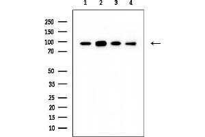 anti-Zinc Finger Protein, X-Linked (ZFX) antibody