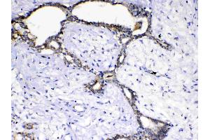 Immunohistochemistry (IHC) image for anti-KIT Ligand (KITLG) (AA 26-190) antibody (ABIN5519022)