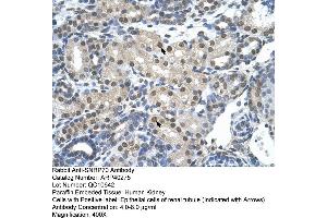 Immunohistochemistry (IHC) image for anti-Small Nuclear Ribonucleoprotein 70kDa (U1) (SNRNP70) (N-Term) antibody (ABIN183913) (SNRNP70 抗体  (N-Term))