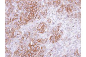 IHC-P Image Immunohistochemical analysis of paraffin-embedded SW480 xenograft, using UST, antibody at 1:500 dilution. (UST 抗体)