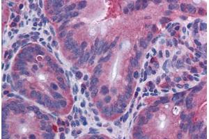 Mouse Small Intestine: Formalin-Fixed, Paraffin-Embedded (FFPE) (IL-10 抗体)