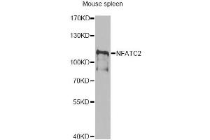 Western blot analysis of extracts of mouse spleen, using NFATC2 antibody (ABIN6292207) at 1:1000 dilution. (NFAT1 抗体)