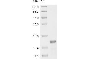 Progesterone Receptor (PGR) (AA 323-419) protein (His-ABP Tag)