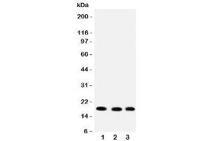 Western blot testing of UBC9 antibody and rat samples 1: heart (UBE2I 抗体  (C-Term))
