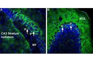 Expression of Na+/K+ ATPase α2 (ATP1A2) in mouse hippocampus and cerebellum - Immunohistochemical staining of perfusion-fixed frozen rat brain sections using Anti-Alpha 2 Na+/K+ ATPase Antibody (ABIN7042961, ABIN7044639 and ABIN7044640), (1:300), followed by goat-anti-rabbit-AlexaFluor-488 secondary antibody. (ATP1A2 抗体  (Intracellular))