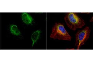 ICC/IF Image PDI antibody [N1N3] detects PDI protein at endoplasmic reticulum by immunofluorescent analysis. (P4HB 抗体)
